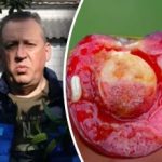 Dlaczego czereśnie stają się robaczywe: nieoczekiwany powód